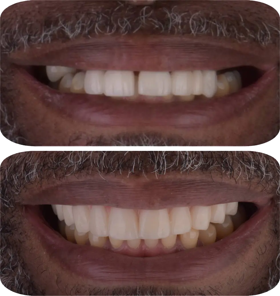 Lumiere Cosmetic and Implant Dentistry | Homepage Image 1