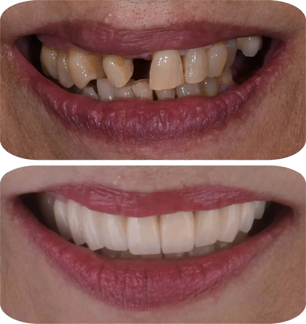 Lumiere Cosmetic and Implant Dentistry | Homepage Image 2