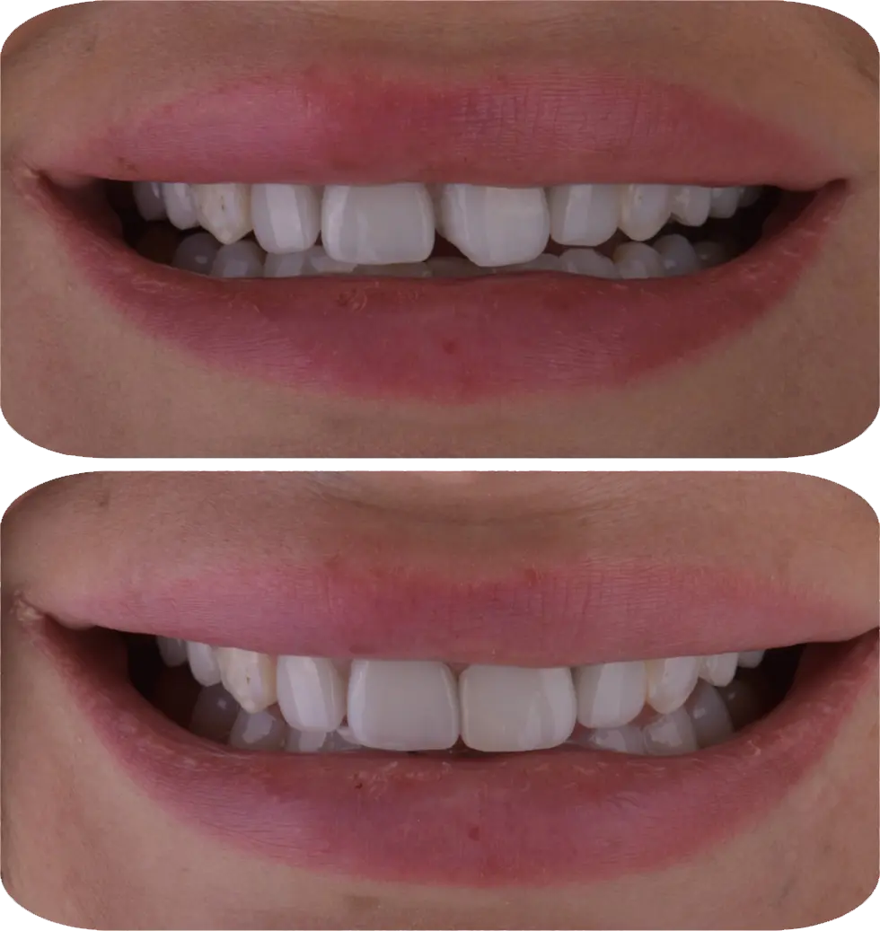 Lumiere Cosmetic and Implant Dentistry | Homepage Image 3