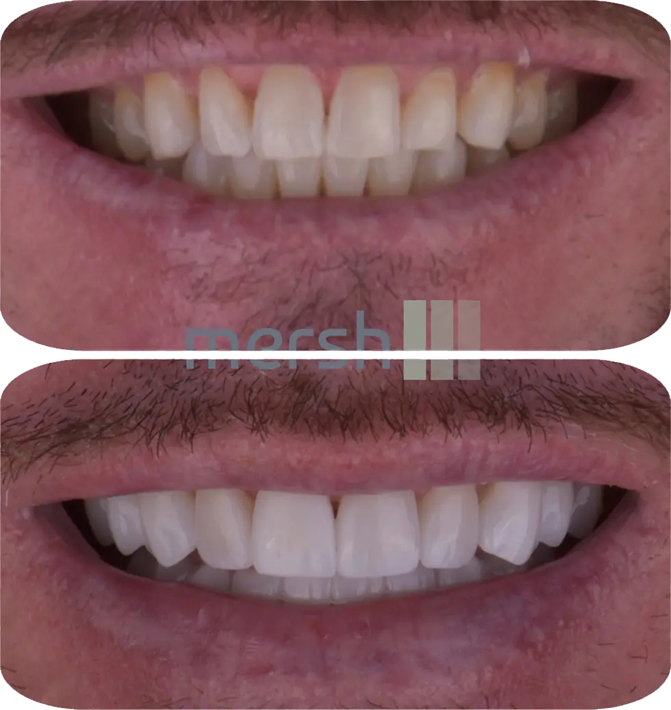 Lumiere Cosmetic and Implant Dentistry | Homepage Image 4