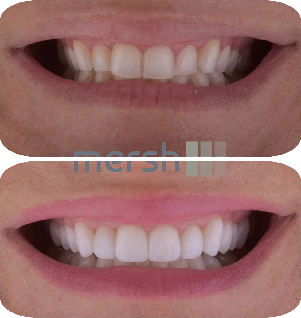 Lumiere Cosmetic and Implant Dentistry | Homepage Image 4