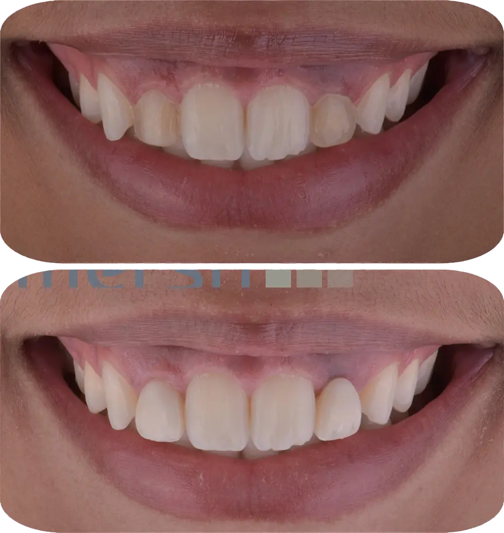 Lumiere Cosmetic and Implant Dentistry | Homepage Image 4
